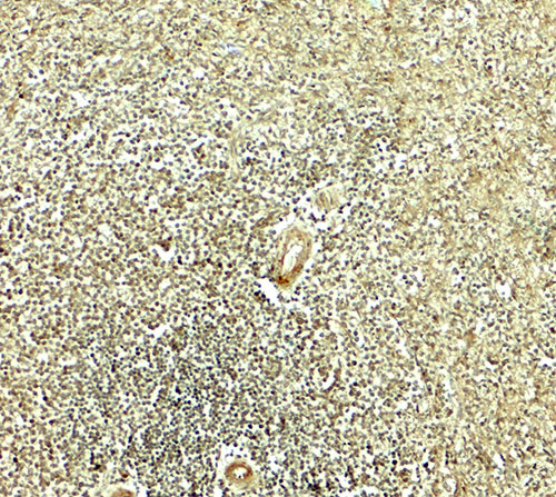 2 - IKZF2 Antibody ASC11900