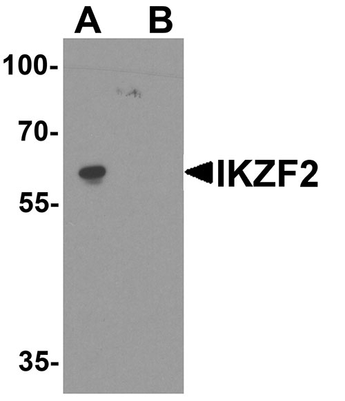 1 - IKZF2 Antibody ASC11900
