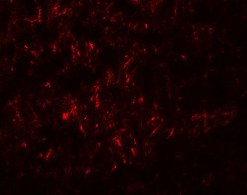 3 - SLC29A4 Antibody ASC11906