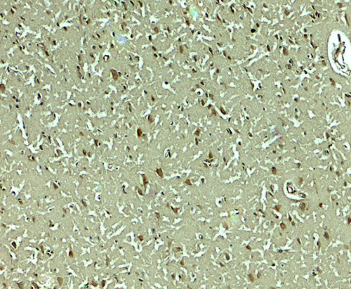 2 - SLC29A4 Antibody ASC11906