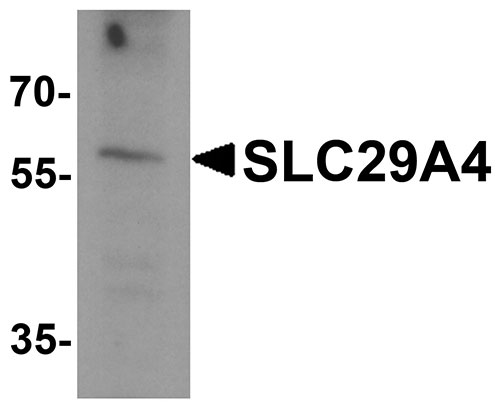 1 - SLC29A4 Antibody ASC11906