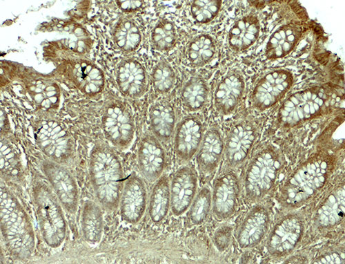 2 - WSB1 Antibody ASC11918
