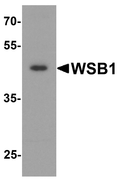1 - WSB1 Antibody ASC11918
