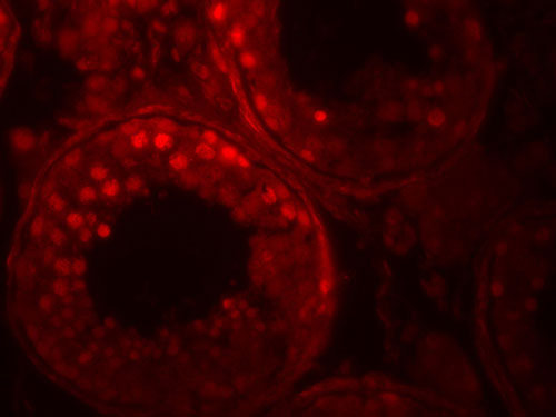 3 - ADAM29 Antibody ASC11925