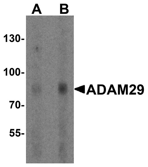 1 - ADAM29 Antibody ASC11925
