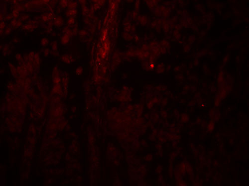 3 - PACS1 Antibody ASC11927