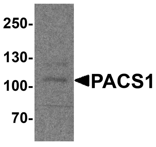 1 - PACS1 Antibody ASC11927