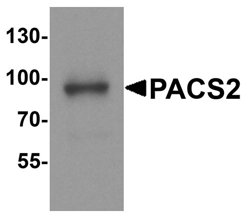 1 - PACS2 Antibody ASC11928