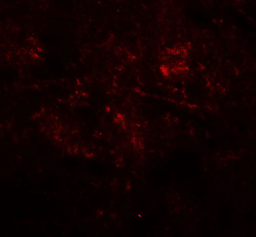 3 - MEK1/2 Antibody ASC11934