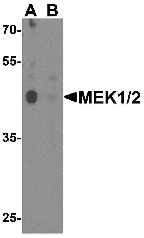1 - MEK1/2 Antibody ASC11934