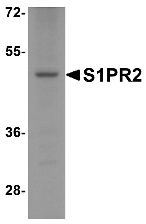 1 - S1PR2 Antibody ASC11940