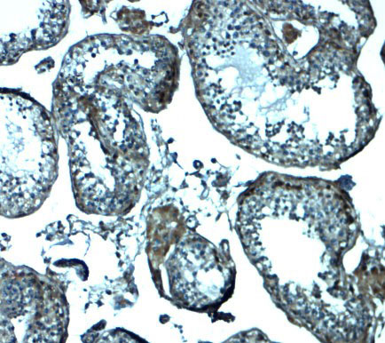 2 - IZUMO1 Antibody ASC11941
