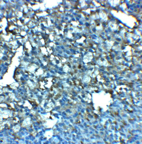 2 - LRRC8A Antibody ASC11942