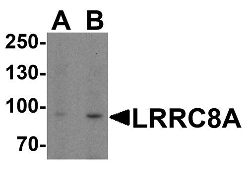 1 - LRRC8A Antibody ASC11942