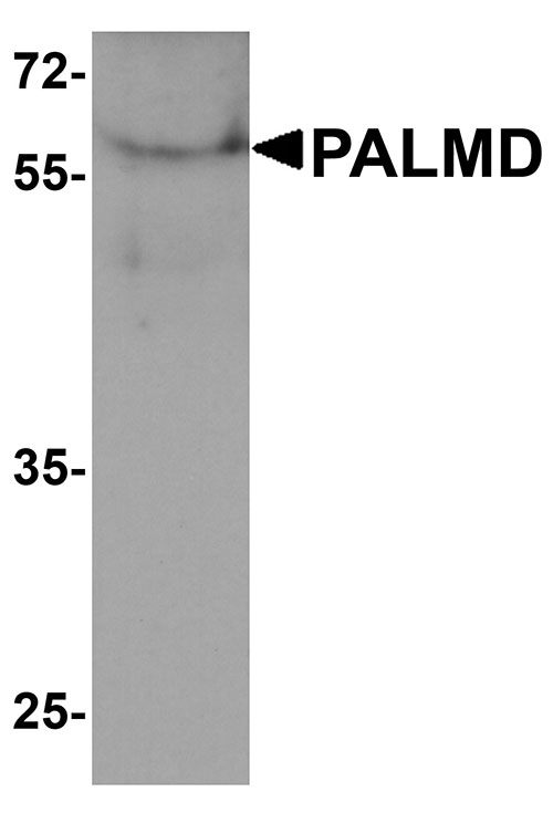 1 - PALMD Antibody ASC11943