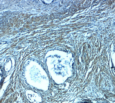 2 - PMEPA1 Antibody ASC11945