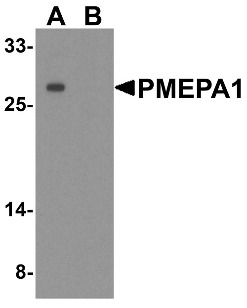 1 - PMEPA1 Antibody ASC11945