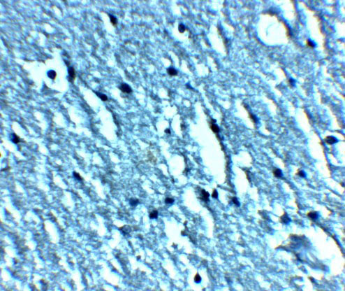 2 - TRPC3 Antibody ASC11946