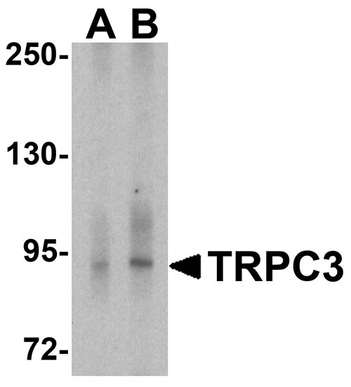 1 - TRPC3 Antibody ASC11946