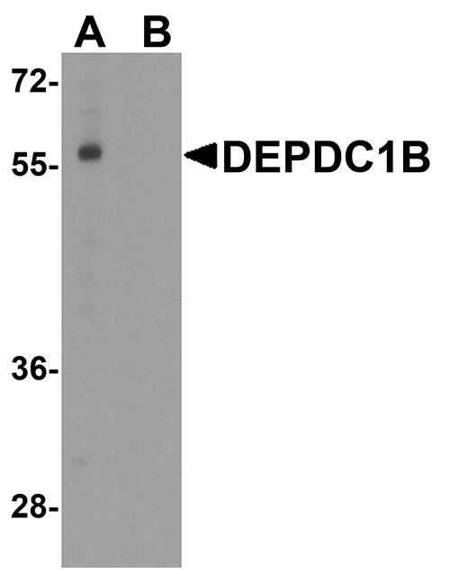 1 - DEPDC1B Antibody ASC11947