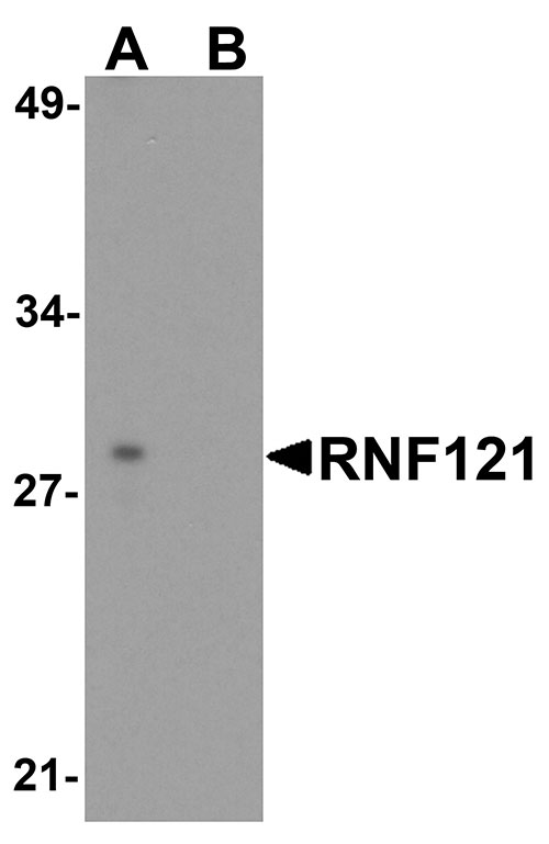 1 - RNF121 Antibody ASC11948