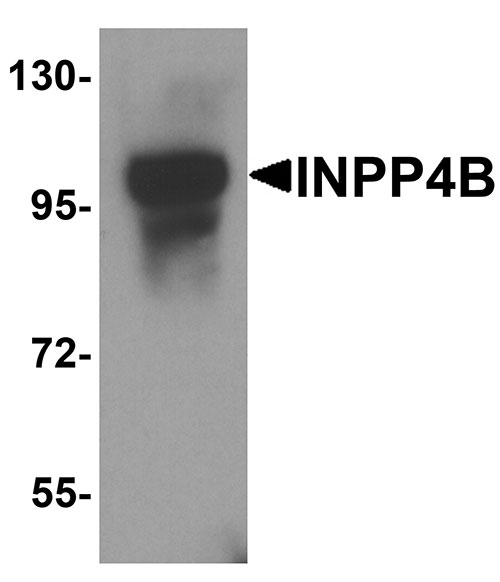 1 - INPP4B Antibody ASC11951