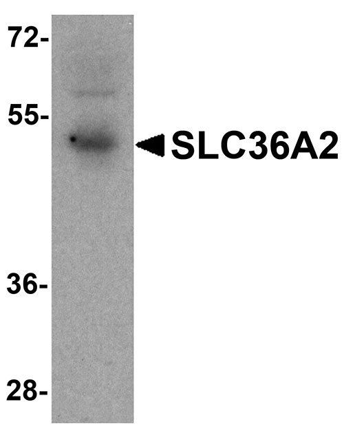 1 - SLC36A2 Antibody ASC11952