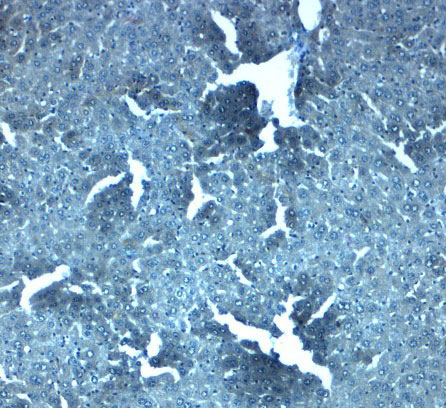 2 - SLC38A4 Antibody ASC11953