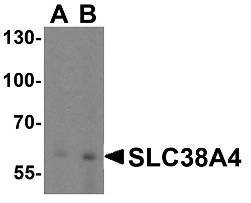 1 - SLC38A4 Antibody ASC11953