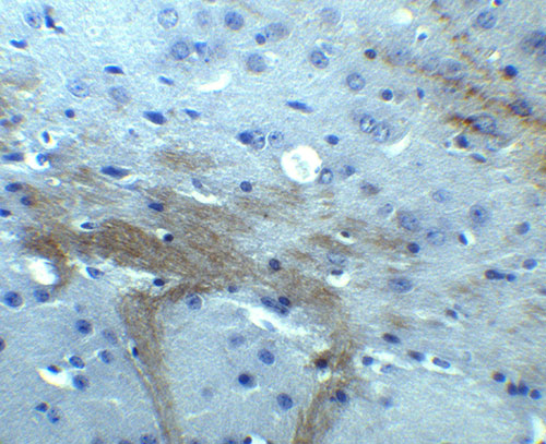 2 - TNFAIP1 Antibody ASC11954