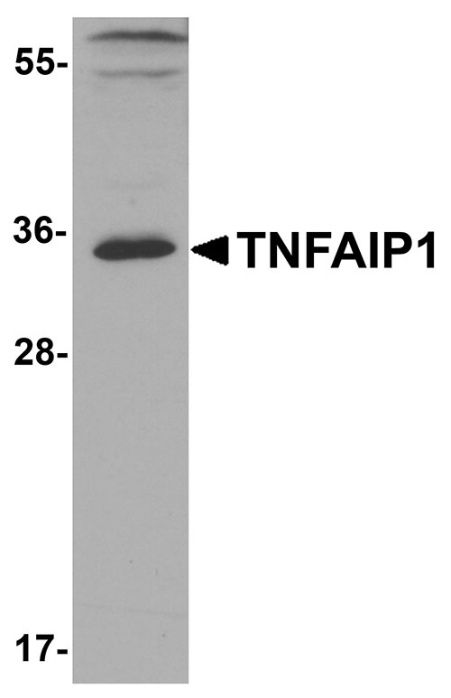 1 - TNFAIP1 Antibody ASC11954
