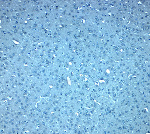 2 - DIS3L2 Antibody ASC11955