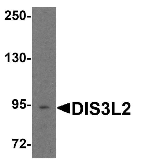 1 - DIS3L2 Antibody ASC11955