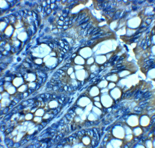 2 - JAGN1 Antibody ASC11957