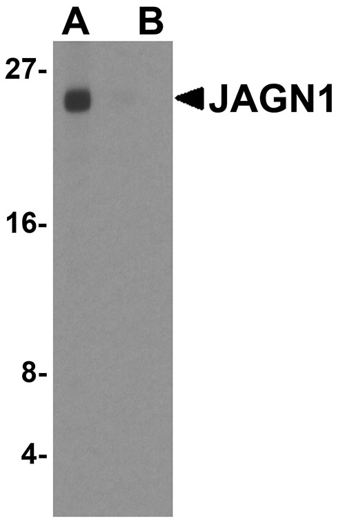 1 - JAGN1 Antibody ASC11957