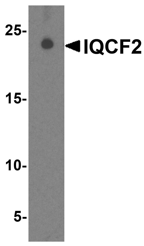 1 - IQCF2 Antibody ASC11961