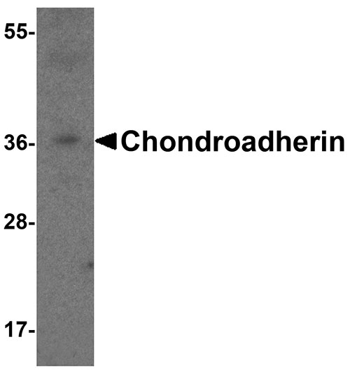 1 - Chondroadherin Antibody ASC11962