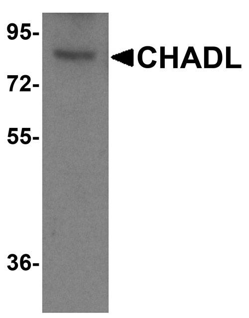 1 - CHADL Antibody ASC11963