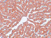 2 - IRAK Antibody [1F12C1]  ASC12009