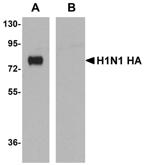 1 - Seasonal H1N1 Hemagglutinin Antibody [7H12F6]  ASC12011