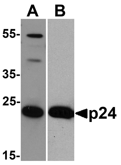 1 - HIV-1 p24 Antibody [8G9]  ASC12019