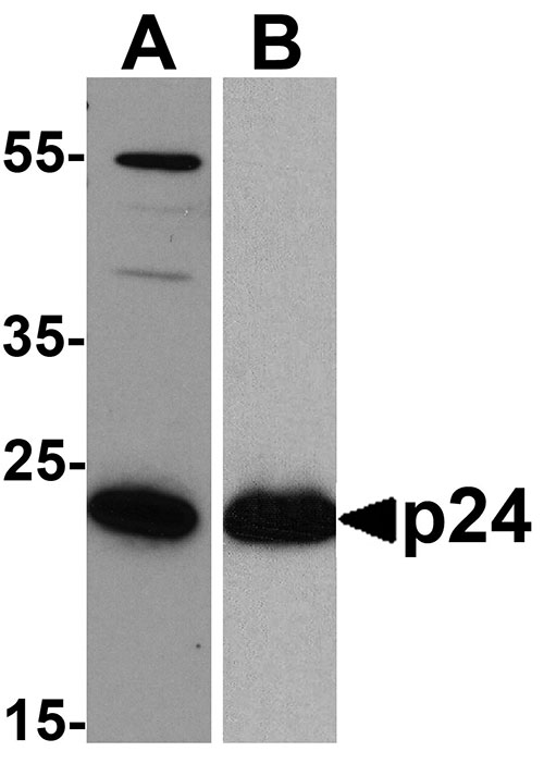 1 - HIV-1 p24 Antibody [7F4]  ASC12022