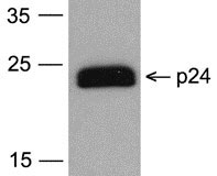 1 - HIV-1 p24 Antibody [7F4] (biotin) ASC12023
