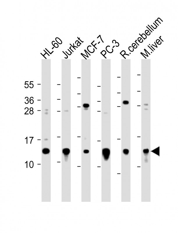 1 - FAU Antibody (C-term) AP1600b
