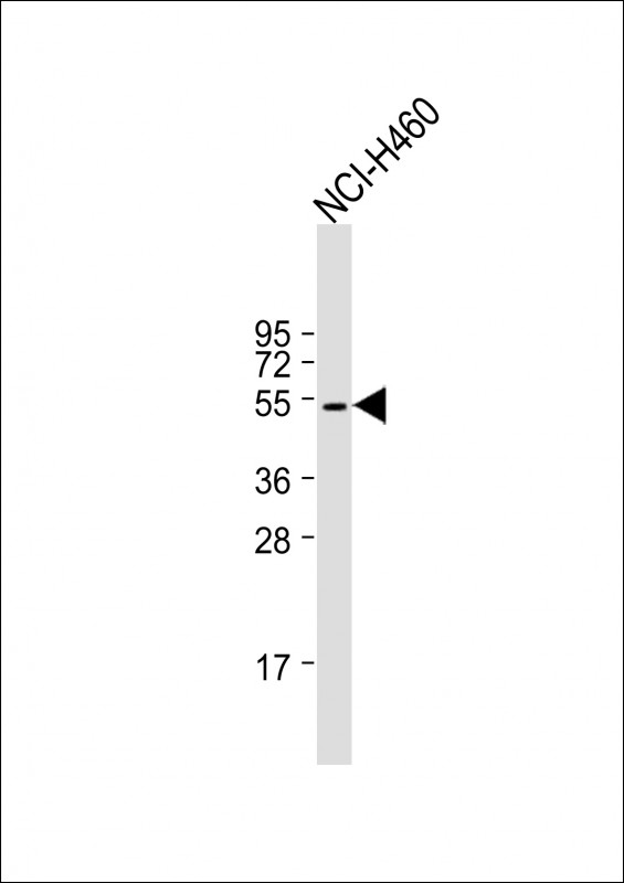 1 - KRT36 Antibody (N-term) AP17586a