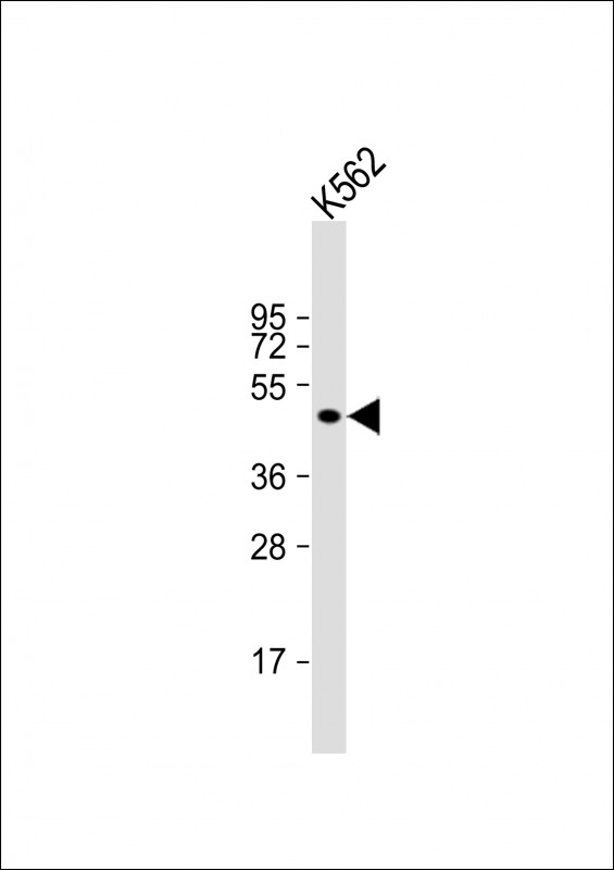 1 - EIF5 Antibody (Center) AP22055c