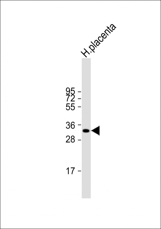 1 - HPGD Antibody (C-term) AP6794b