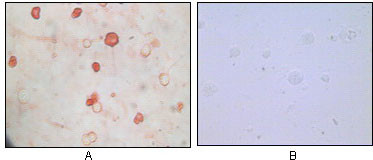 2 - KSHV K8a Antibody AO1015a