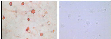 2 - KSHV K8a Antibody AO1015a