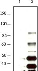 1 - KSHV K8a Antibody AO1015a